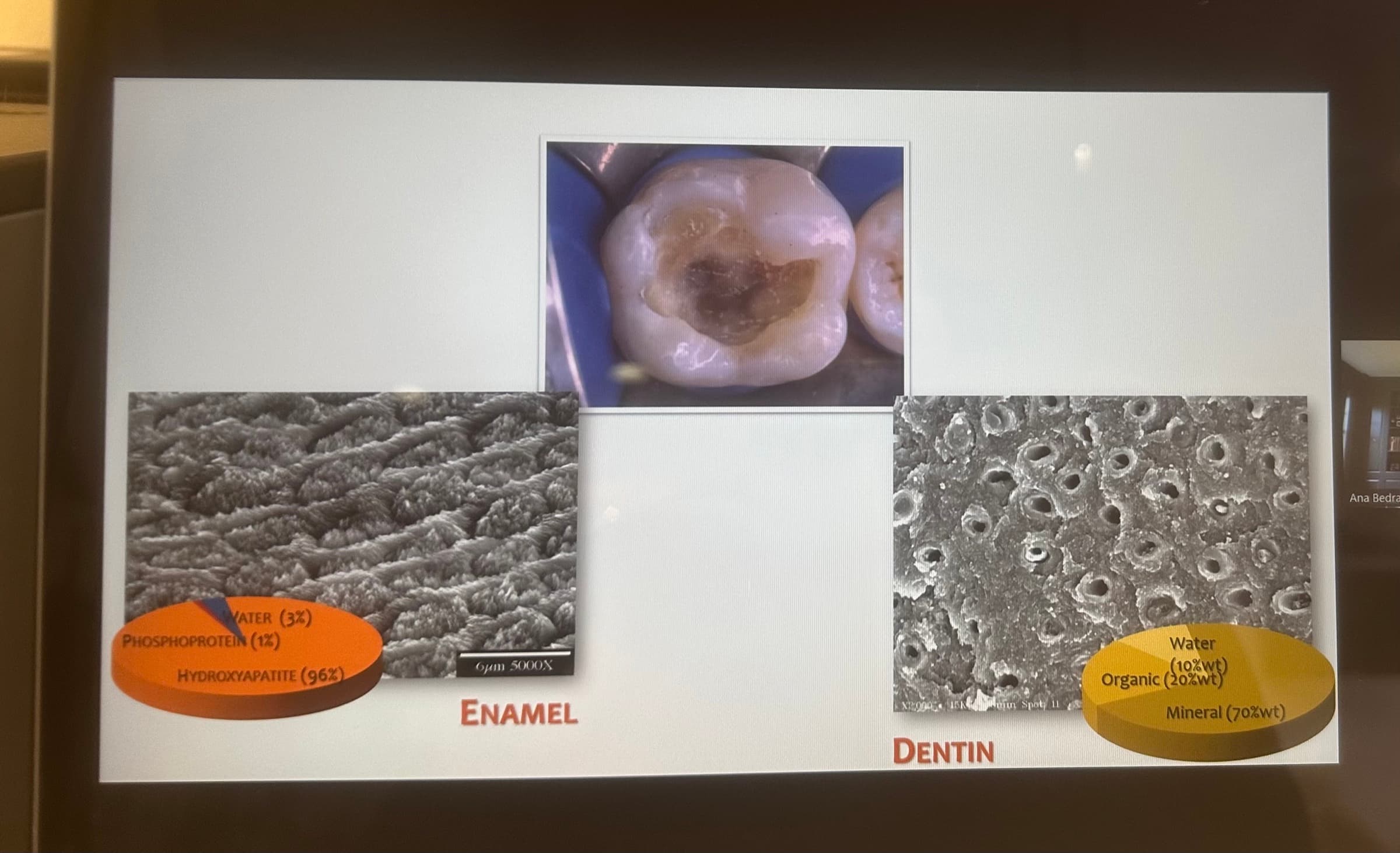Advanced Dental Adhesive Materials by Ana Bedran-Russo — slide 1