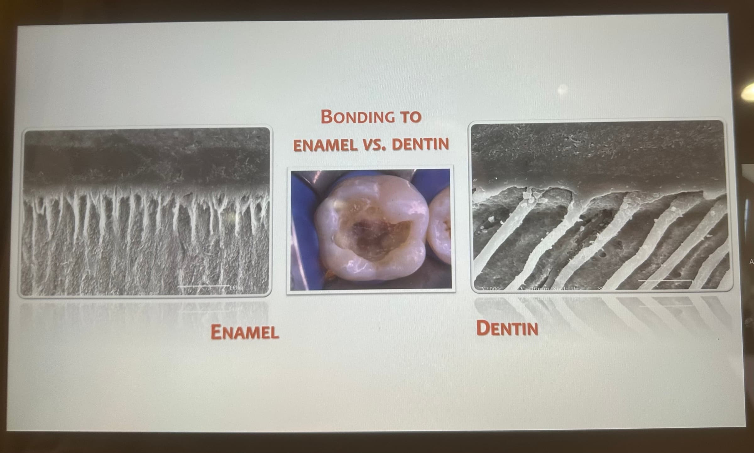 Advanced Dental Adhesive Materials by Ana Bedran-Russo — slide 2