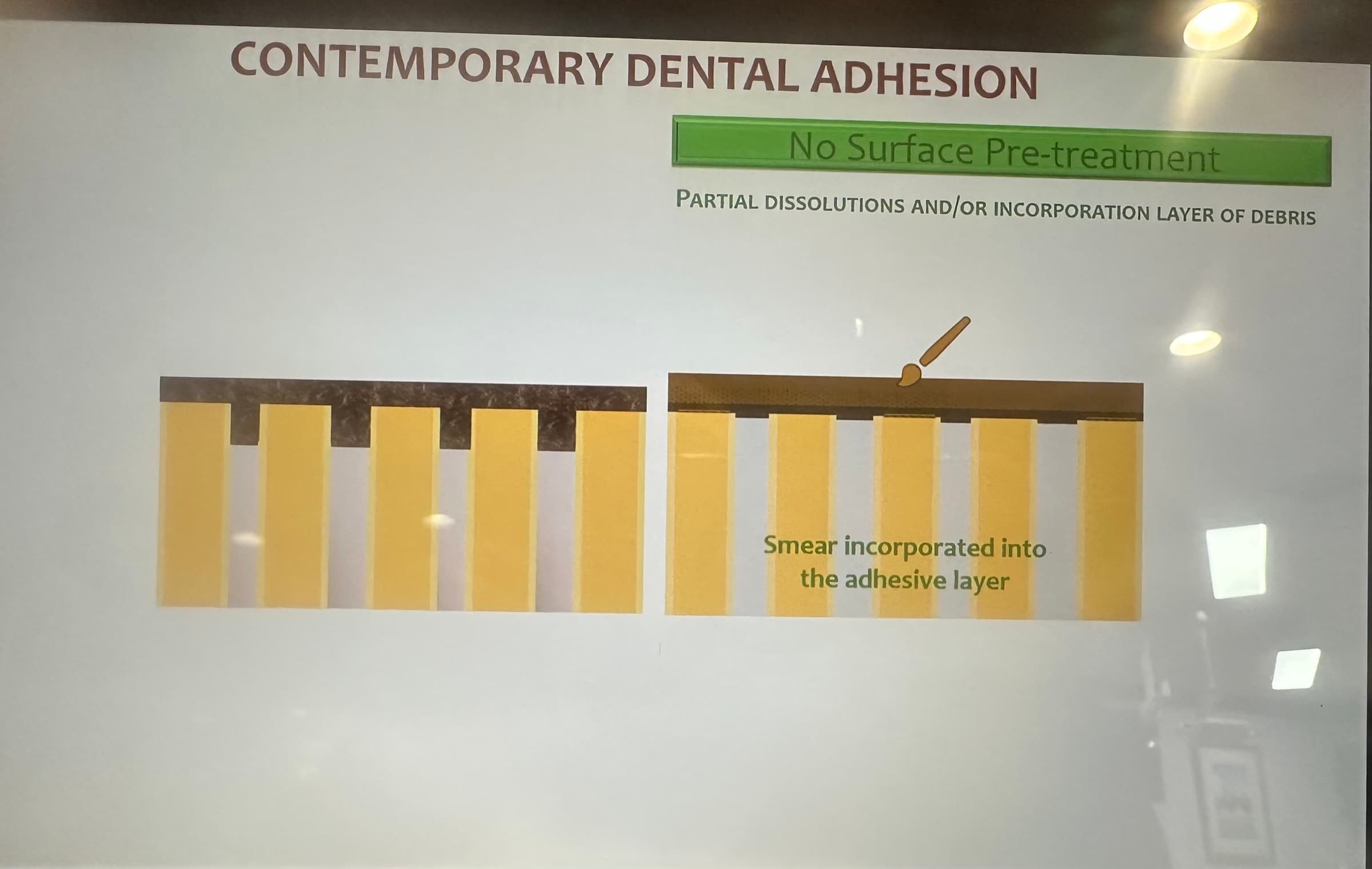 Advanced Dental Adhesive Materials by Ana Bedran-Russo — slide 5