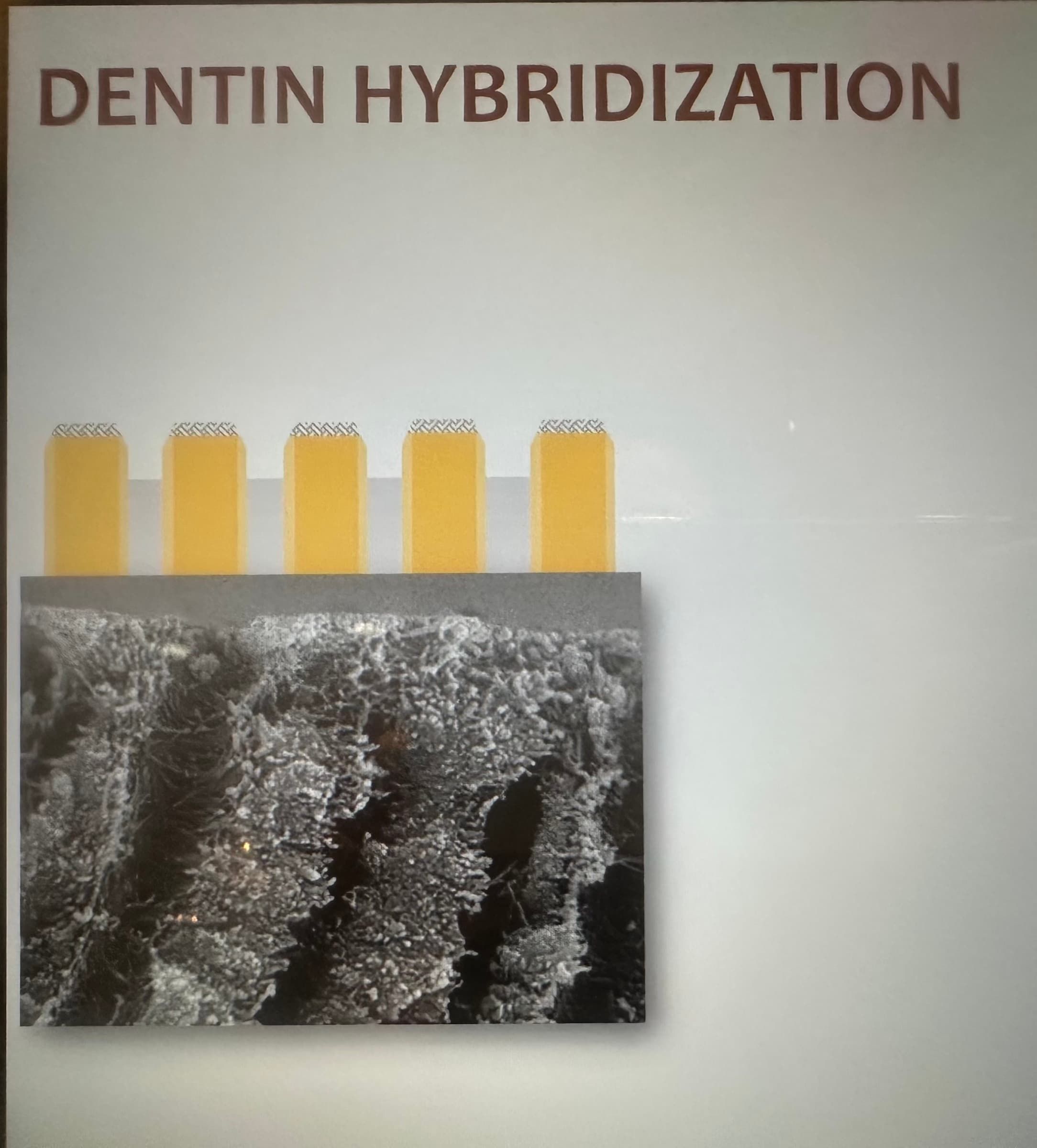 Advanced Dental Adhesive Materials by Ana Bedran-Russo — slide 13