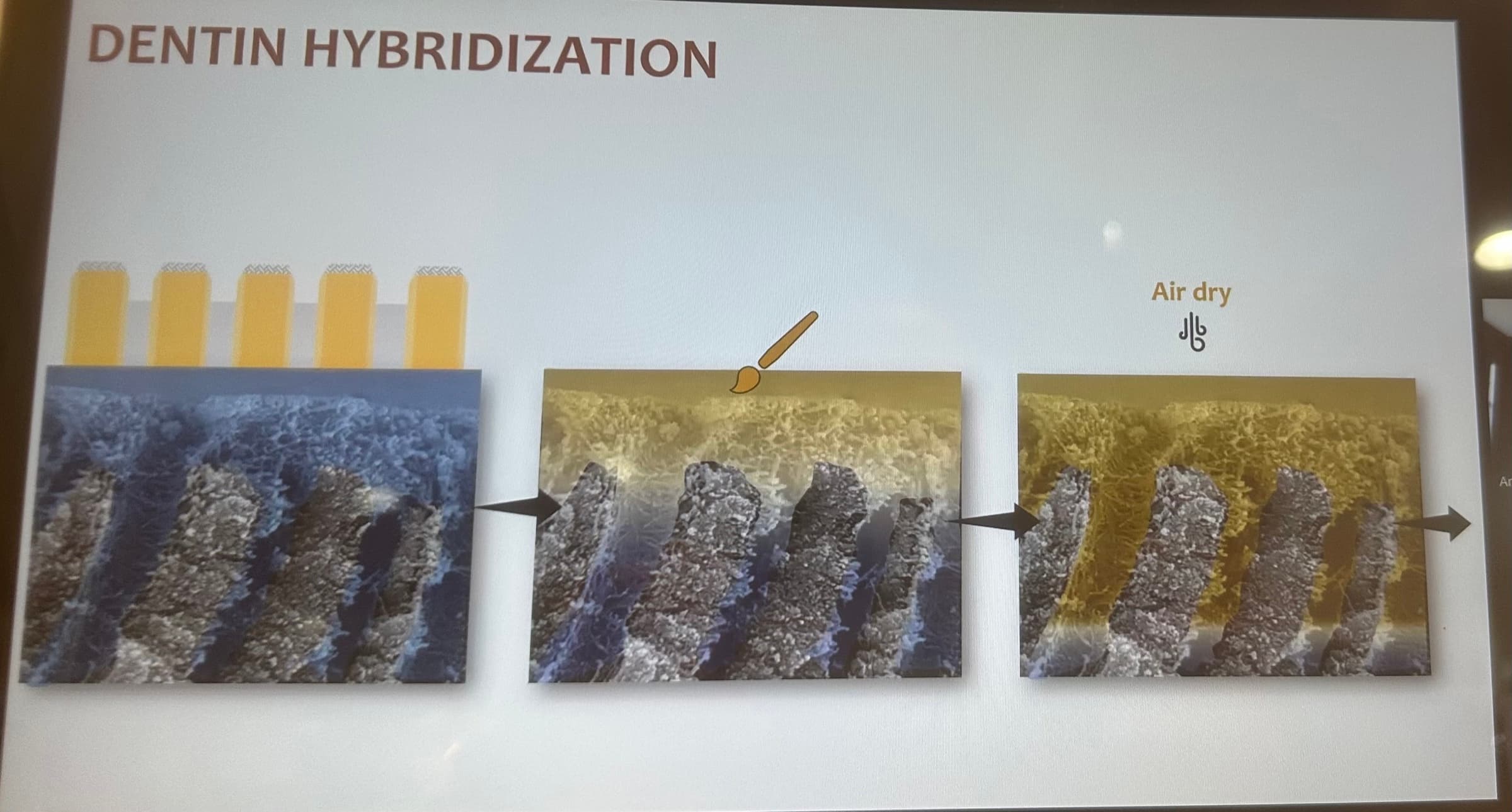 Advanced Dental Adhesive Materials by Ana Bedran-Russo — slide 14