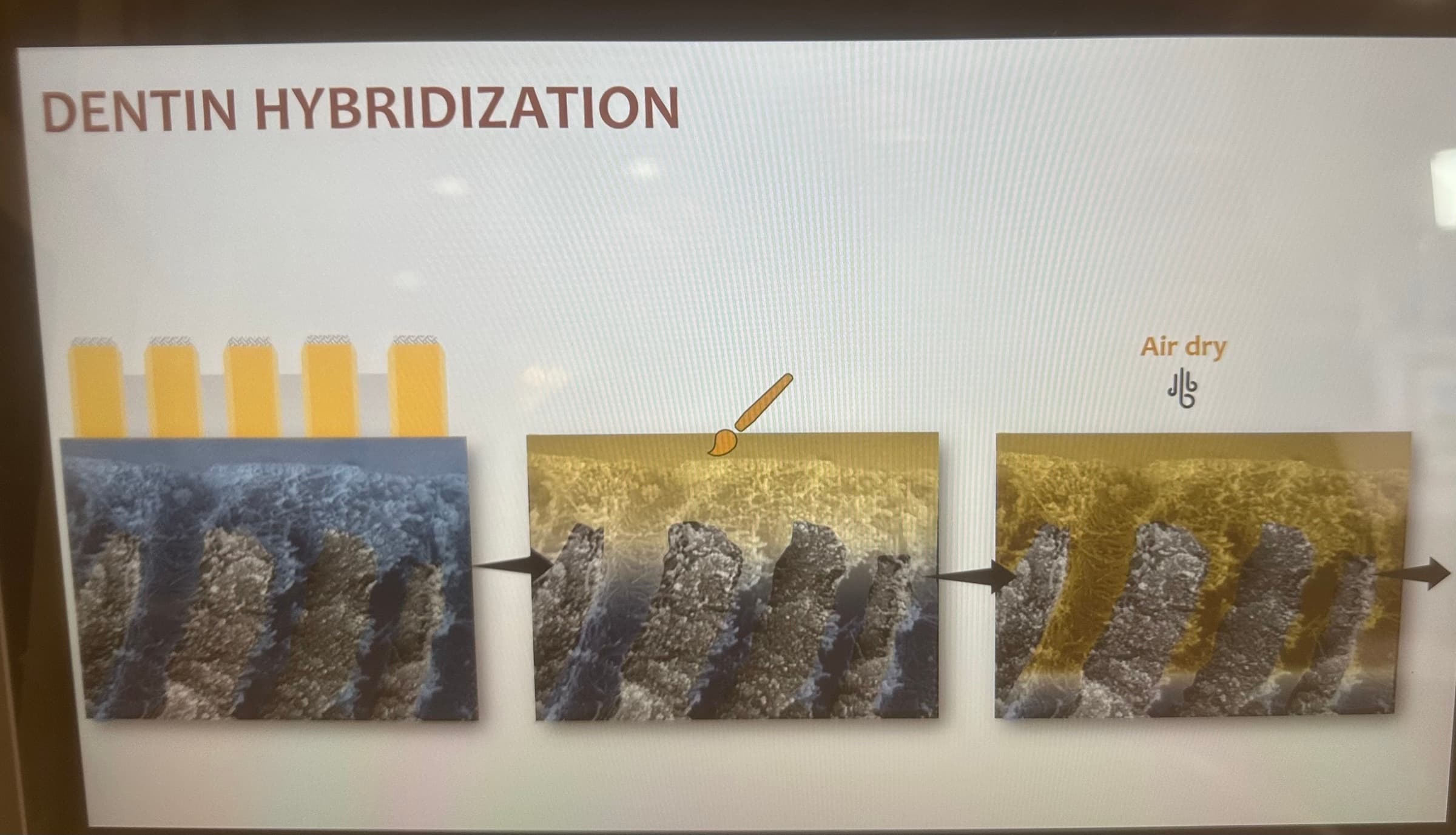 Advanced Dental Adhesive Materials by Ana Bedran-Russo — slide 15