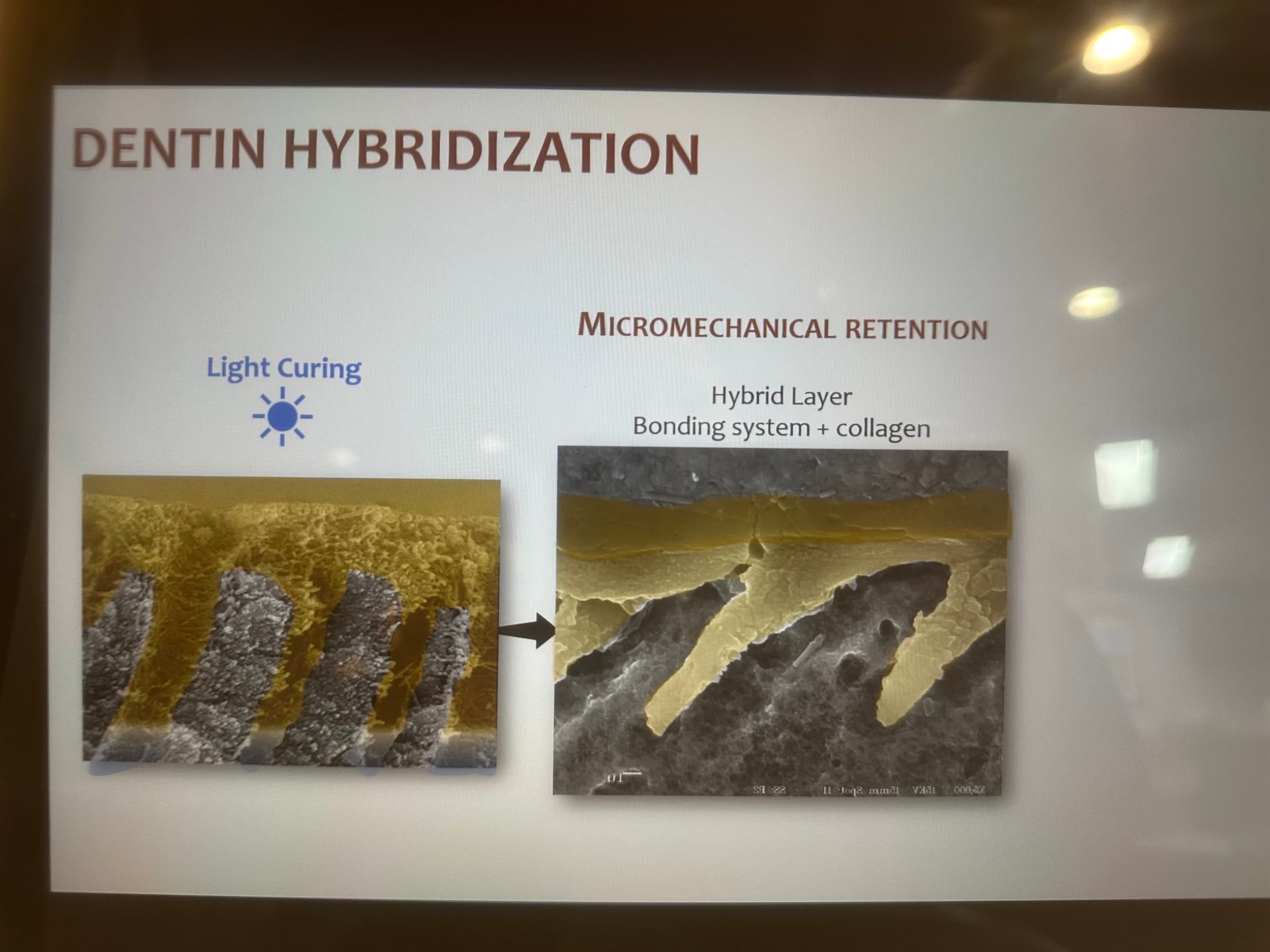 Advanced Dental Adhesive Materials by Ana Bedran-Russo — slide 16