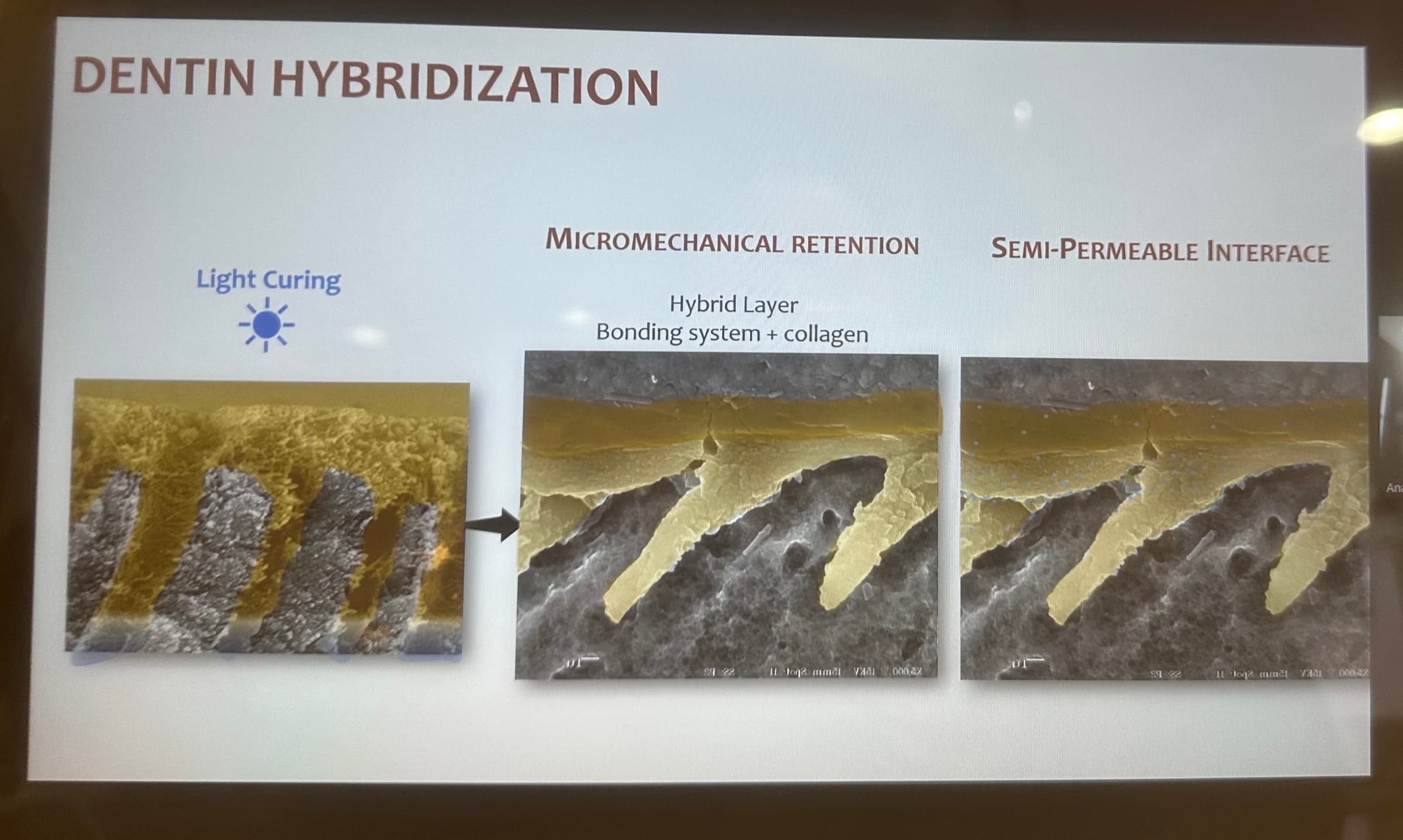Advanced Dental Adhesive Materials by Ana Bedran-Russo — slide 17