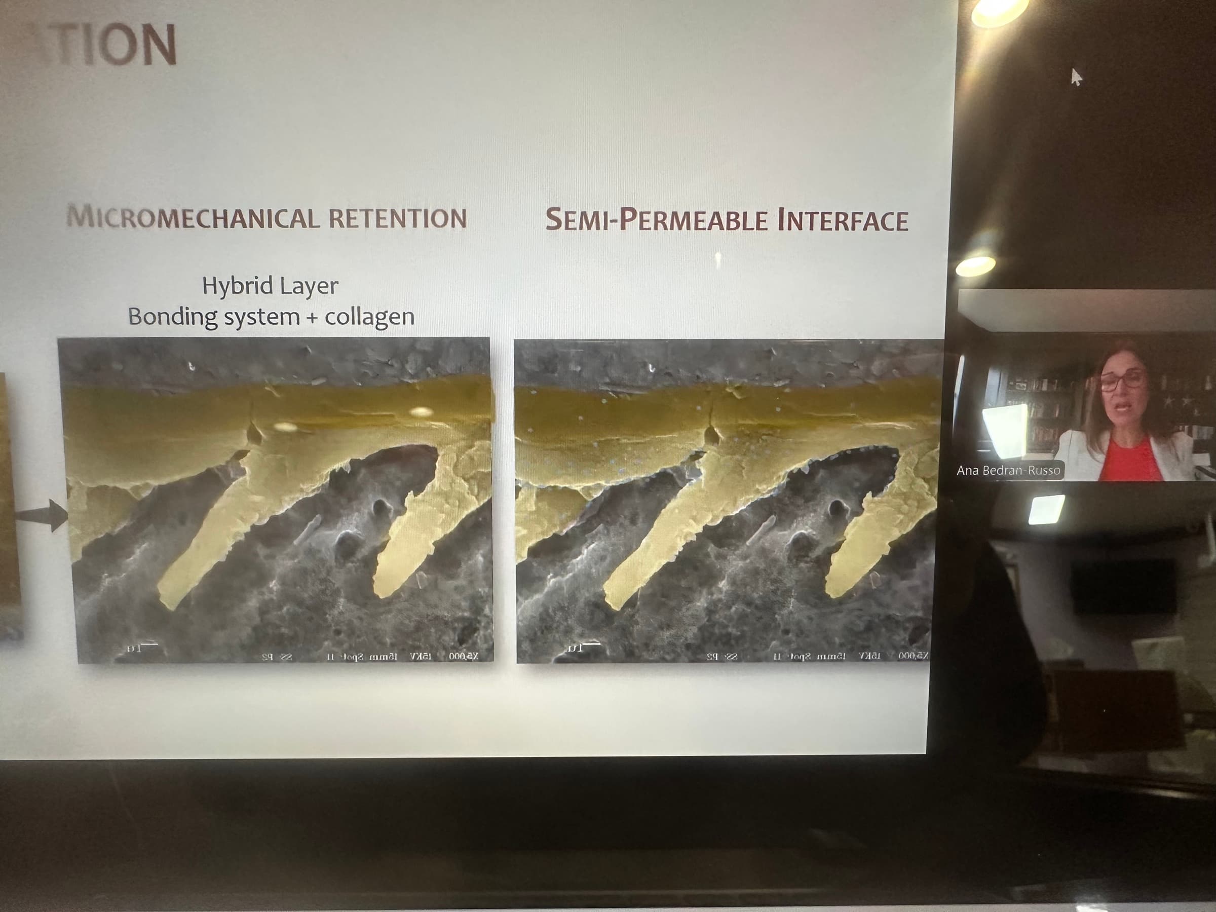 Advanced Dental Adhesive Materials by Ana Bedran-Russo — slide 18