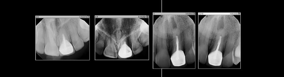 Menlo Park Dental Excellence treatment room photo 9