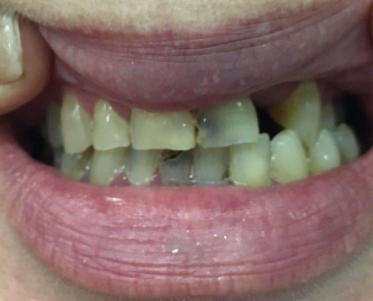 Case 9 — 1.5 hours later before — photo 2