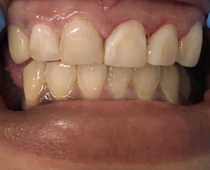 Case 8 — 2 hours later after — photo 1