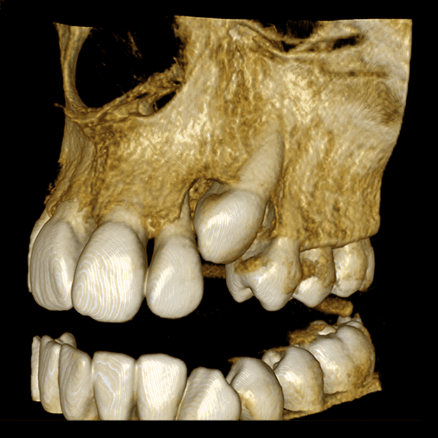 3D dental scan 3