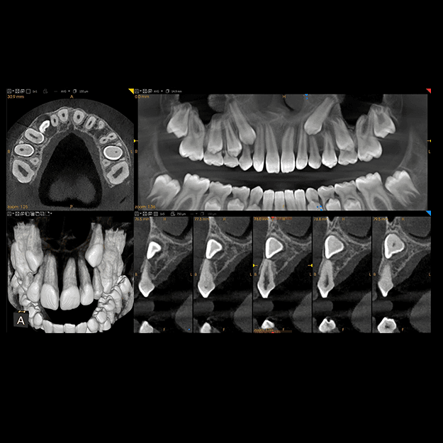 3D dental scan 2