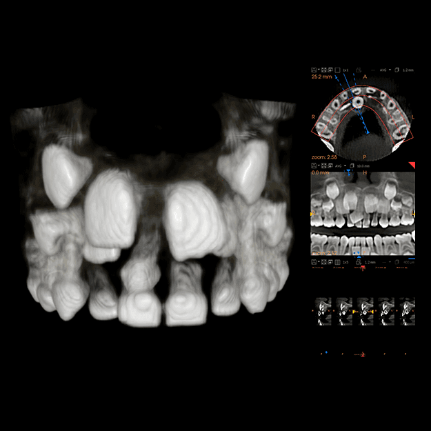 3D dental scan 1