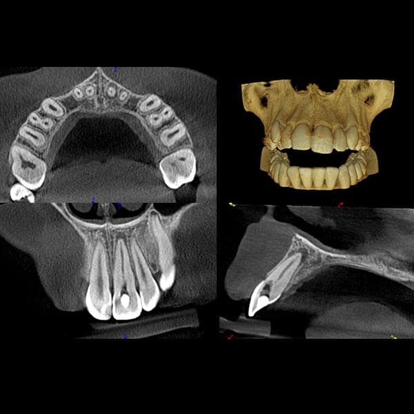 3D dental scan 10