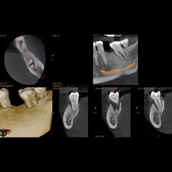 3D dental scan 9