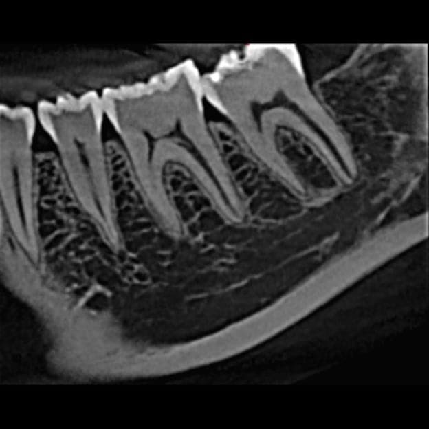 3D dental scan 8
