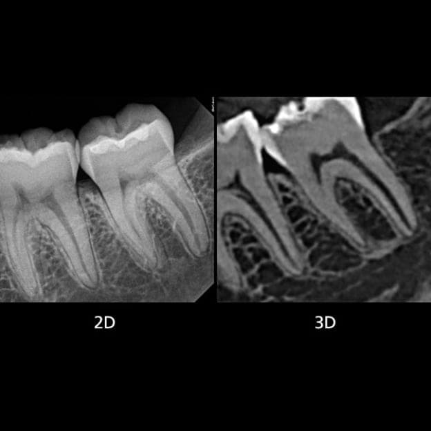 3D dental scan 7