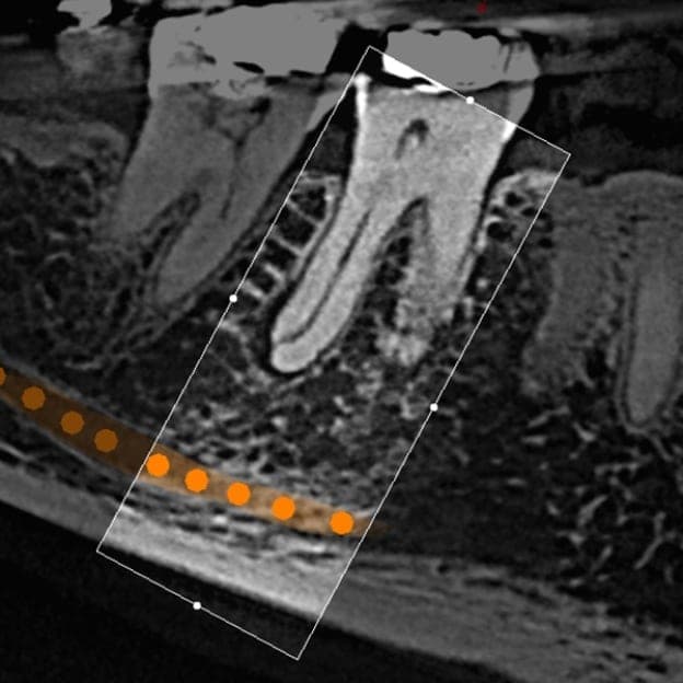 3D dental scan 6