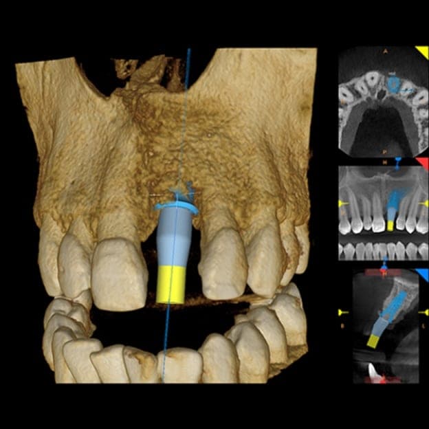 3D dental scan 5