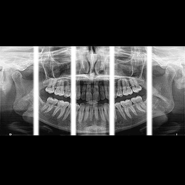 Panoramic dental X-ray 1