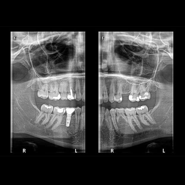 Panoramic dental X-ray 4