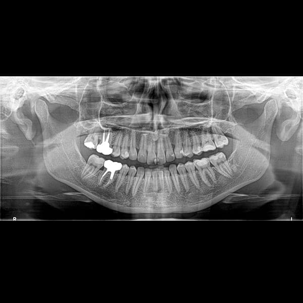 Panoramic dental X-ray 5