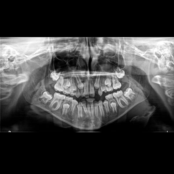 Panoramic dental X-ray 6