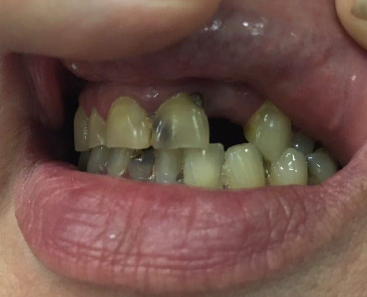 Patient 3 before — photo 1