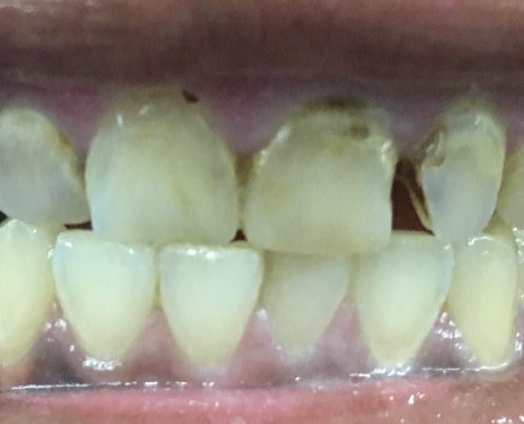 Patient 4 before — photo 2