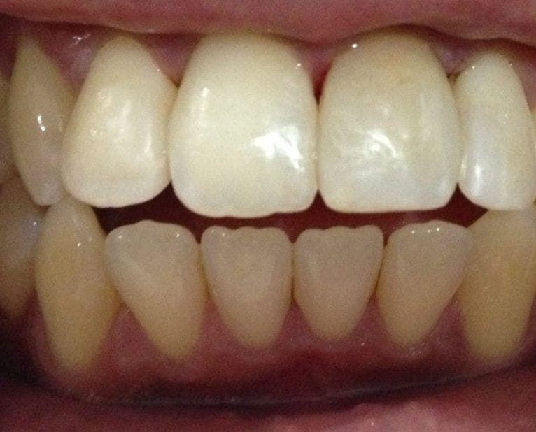 Case 2 — photo 1