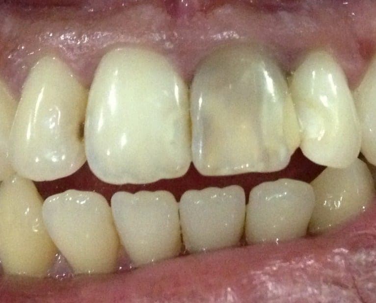 Case 2 — photo 2