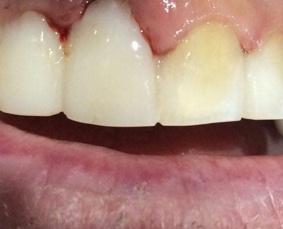 Case 4 — photo 4