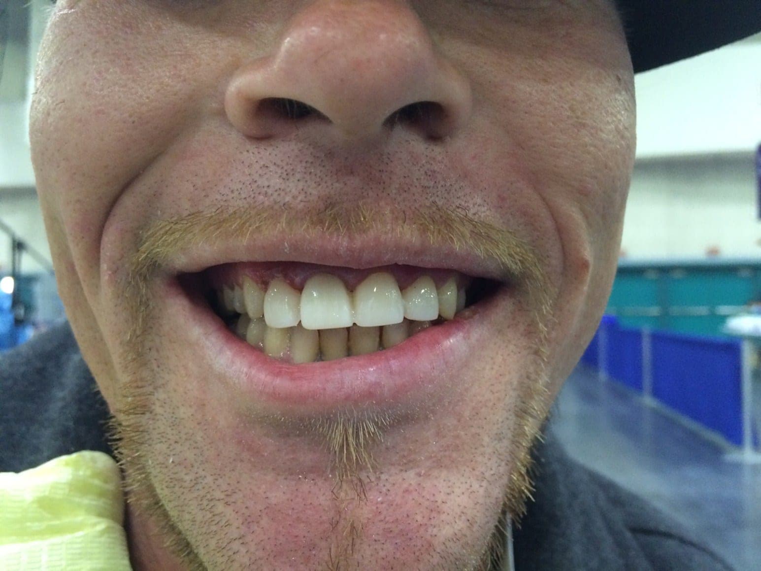 Jason Edward Tharpe — treatment photo 1
