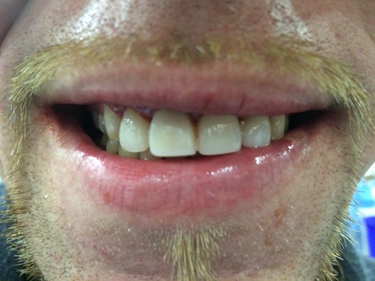 Jason Edward Tharpe — treatment photo 2