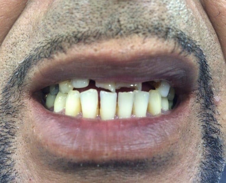 Case 5 before — photo 3