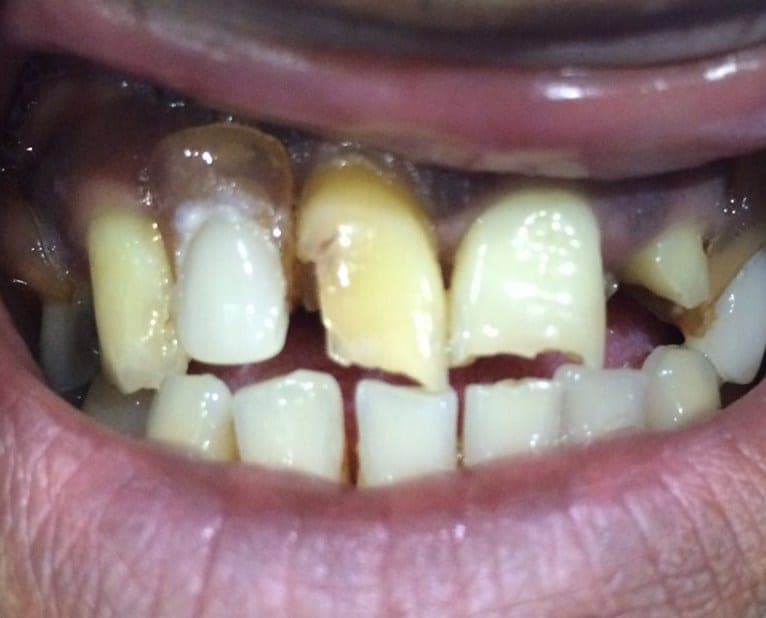 Case 5 before — photo 2