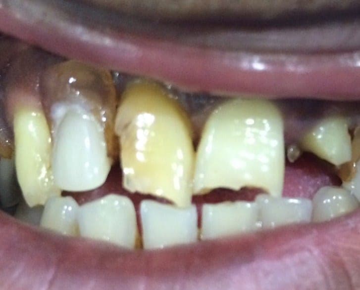 Case 5 before — photo 1