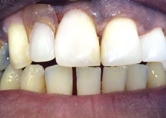 Case 5 after — photo 3