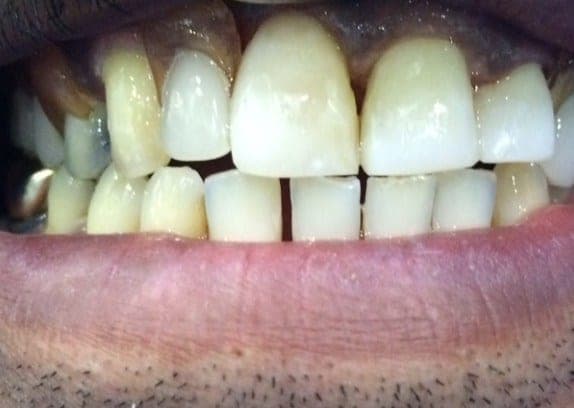 Case 5 after — photo 2
