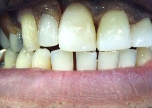 Case 5 after — photo 1