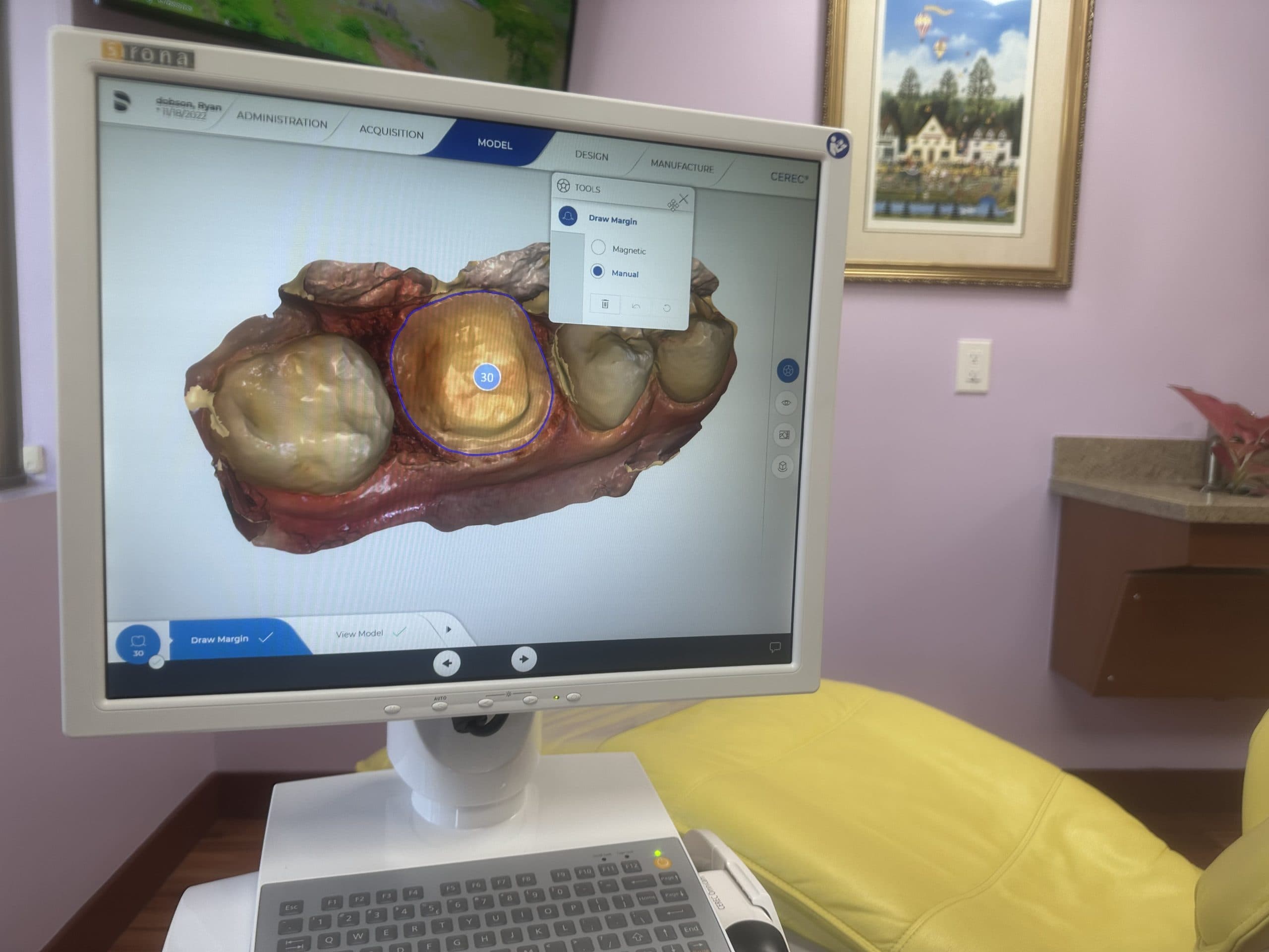 Patient case 3