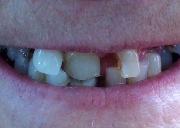 Case 7 — 4 hours later before — photo 1