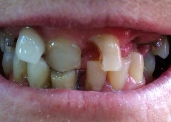 Case 7 — 4 hours later before — photo 2