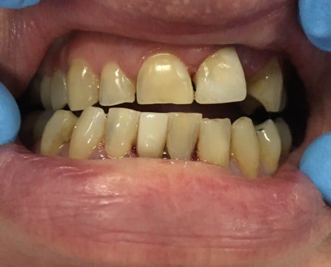 Patient 3 after