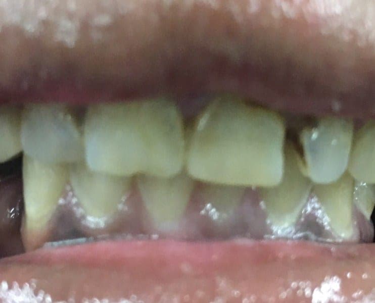 Patient 4 before — photo 1