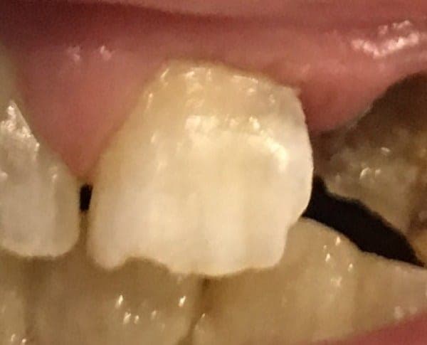 Patient 2 before — photo 1