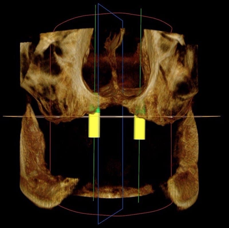Practice example dental X-ray 1