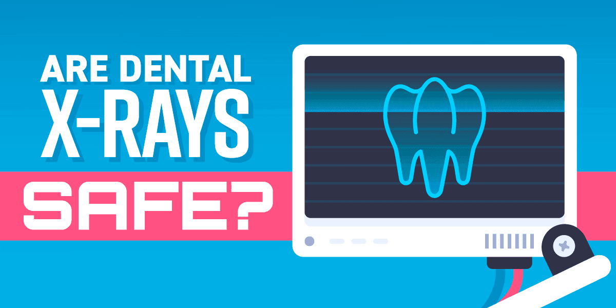 Are Dental X-Rays Safe?
