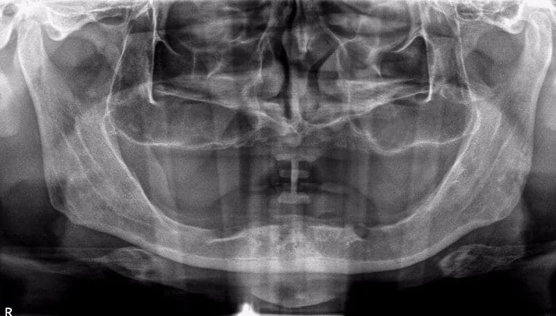 Practice example dental X-ray 2