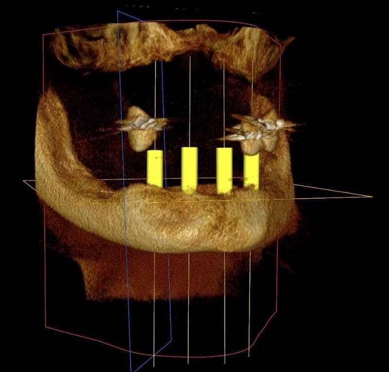 Practice example dental X-ray 3