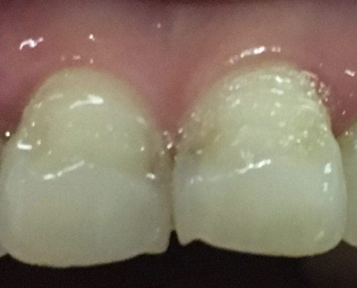 Patient 1 before — photo 1
