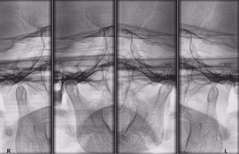Practice example dental X-ray 5